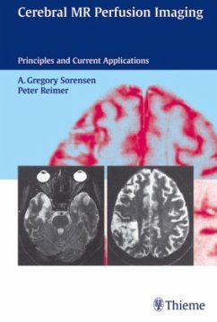 Gregory Sorensen Peter Reimer - Cerebral MR Perfusion Imaging, w. CD-ROM: Principles and Current Applications