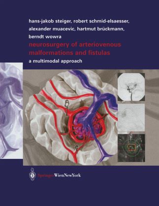 Neurosurgery of Arteriovenous Malformations and Fistulas: A Multimodal Approach Robert Schmid-Elsaesser, Alexander Muacevic, Hartmut Bruckmann and Berndt Wowra