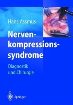 Hans Assmus Gregor Antoniadis - Nervenkompressionssyndrome. Diagnostik und Chirurgie
