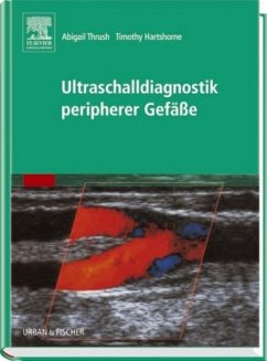 Abigail Thrush (Herausgeber), Timothy Hartshorne - Ultraschalldiagnostik peripherer Gefsse