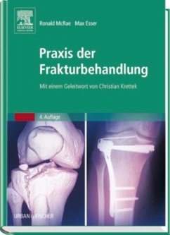Ronald McRae Max Esser Kristoff Jckle Christian Krette - Praxis der Frakturbehandlung: Mit einem Geleitwort