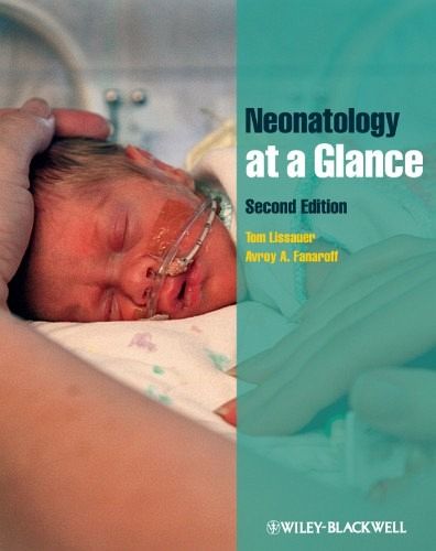 Neonatology At A Glance Pdf