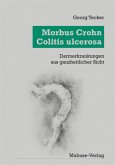 Morbus Crohn - Colitis Ulcerosa