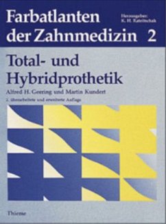 Totalprothetik und Hybridprothetik / Farbatlanten der Zahnmedizin Bd.2 - Geering, Alfred / Kundert, Martin