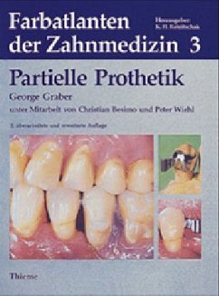 Partielle Prothetik / Farbatlanten der Zahnmedizin Bd.3 - Graber, George