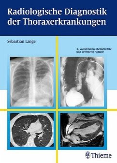 Radiologische Diagnostik der Thoraxerkrankungen - Lange, Sebastian