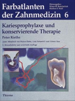 Kariesprophylaxe und konservierende Therapie / Farbatlanten der Zahnmedizin Bd.6 - Riethe, Peter / Hahn, Rainer / Netuschil, Lutz / Rau, Günter