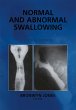 Normal and Abnormal Swallowing - Bild 1