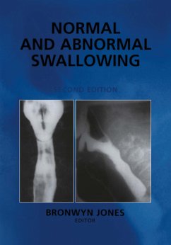 Normal and Abnormal Swallowing - Jones, Bronwyn (ed.)