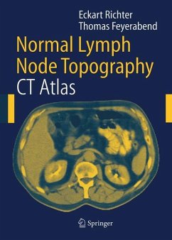 Normal Lymph Node Topography - Richter, Eckart;Feyerabend, Thomas