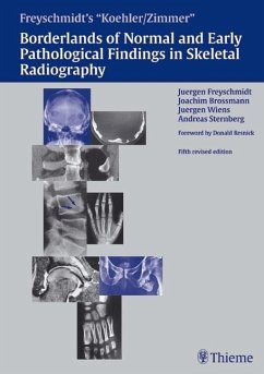 Borderlands of Normal and Early Pathologic Findings in Skeletal Radiograph - Wiens, Jürgen;Sternberg, Andreas