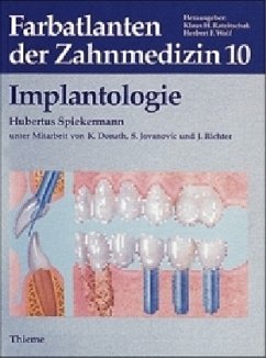 Implantologie / Farbatlanten der Zahnmedizin 10 - Spiekermann, Hubertus / Donath, Karl / Jovanovic, Sascha / Richter, Ernst J