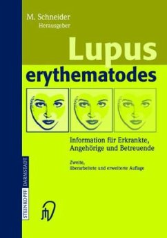 Lupus erythematodes - Schneider, Matthias (Hrsg.)