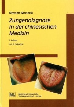 Zungendiagnose in der chinesischen Medizin - Maciocia, Giovanni C.