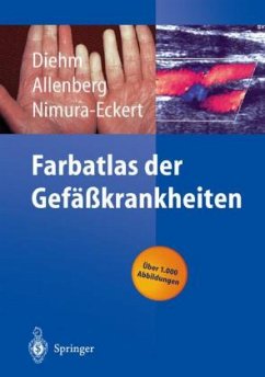 Farbatlas der Gefäßkrankheiten - Diehm, Curt / Allenberg, J.-R. / Nimura-Eckert, Keiko