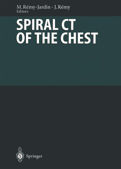 Spiral CT of the Chest