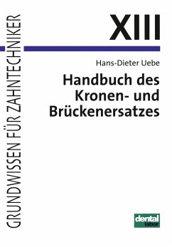 Handbuch des Kronen- und Brückenersatzes - Uebe, Hans-Dieter