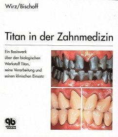 Titan in der Zahnmedizin - Wirz, Jakob;Bischoff, Heiko