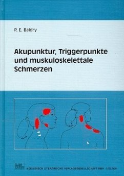 Akupunktur, Triggerpunkte und muskuloskelettale Schmerzen - Baldry, Peter E.