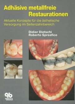 Adhäsive metallfreie Restaurationen - Spreafico, Roberto;Dietschi, Didier