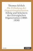 Die Erfindung der Organtransplantation