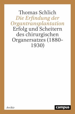 Die Erfindung der Organtransplantation - Schlich, Thomas