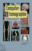 Computertomographie, m. CD-ROM Computertomographie, m. CD-ROM