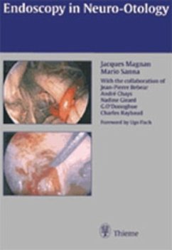 Endoscopy in Neuro-Otology - Magnan, Jacques;Sanna, Mario