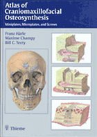 Atlas of Craniomaxillofacial Osteosynthesis - Härle, Franz / Champy, Maxime / Terry, Bill C / Blez, Patrick / Booth, Peter W / Bos, Rudolf R