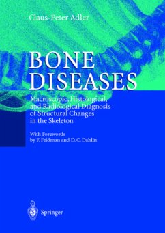 Bone Diseases - Adler, Claus-Peter