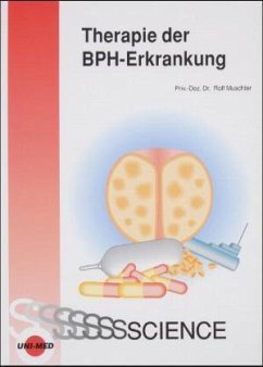 Therapie der BPH-Erkrankung