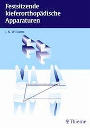 Festsitzende kieferorthopädische Apparaturen Festsitzende kieferorthopädische Apparaturen