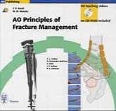 AO Principles of Fracture Management