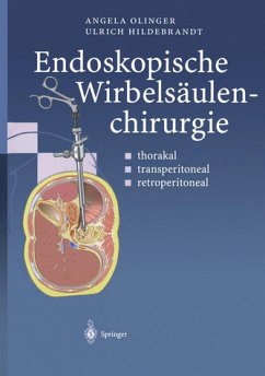 Cover Endoskopische Wirbelsäulenchirurgie