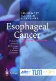 Esophageal Cancer, 1 CD-ROM