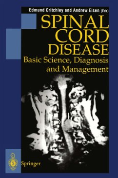 Spinal Cord Disease - Critchley, Edmund / Eisen, Andrew (Hgg.)