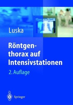 Röntgenthorax auf Intensivstationen - Luska, Günter (Hrsg.)