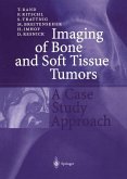 Imaging of Bone and Soft Tissue Tumors
