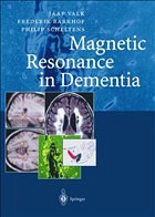 Magnetic Resonance in Dementia - Valk, Jaap; Barkhof, Frederik; Scheltens, Philip