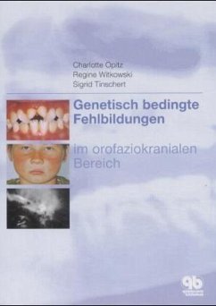 Genetisch bedingte Fehlbildungen im orofaziokranialen Bereich - Opitz, Charlotte; Witkowski, Regine; Tinschert, Sigrid