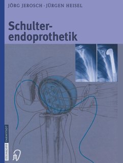Schulterendoprothetik - Jerosch, Jörg;Heisel, Jürgen