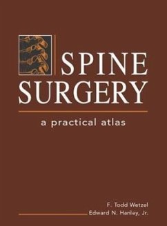 Spine Surgery: A Practical Atlas - Wetzel, F. Todd; Hanley, Edward Nathaniel; Hanley, Jr.