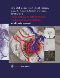 Neurosurgery of Arteriovenous Malformations and Fistulas - Schmid-Elsaesser, Robert;Muacevic, Alexander;Brückmann, Hartmut