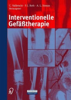 Interventionelle Gefäßtherapie - Vallbracht, Christian / Roth, F.-J. / Strauss, A.L. (Hgg.)