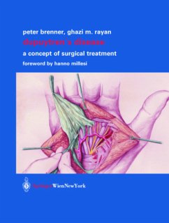 Dupuytren¿s Disease - Brenner, Peter;Rayan, Ghazi M.