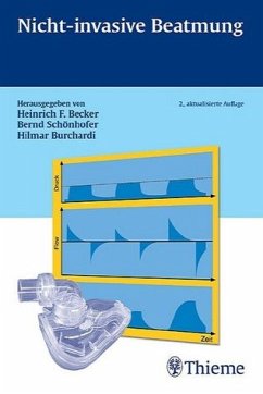 Nicht-invasive Beatmung - Hrsg. v. Heinrich F. Becker, Bernd Schönhofer u. Hilmar Burchardi
