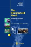 The Rheumatoid Hand