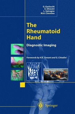 The Rheumatoid Hand - Garlaschi, G.; Silvestri, E.; Satragno, L.; Cimmino, M a