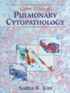 Color Atlas of Pulmonary Cytopathology - Kini, Sudha R.