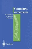 Vertebral metastases